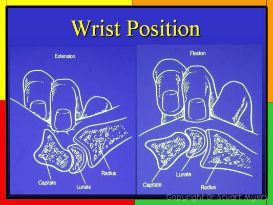 Carpal Bone Anatomy