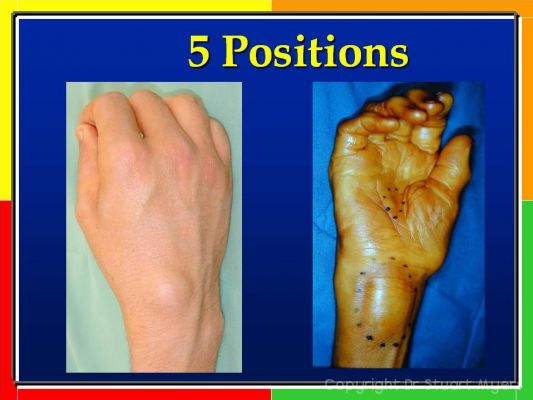 Hand And Wrist Examination