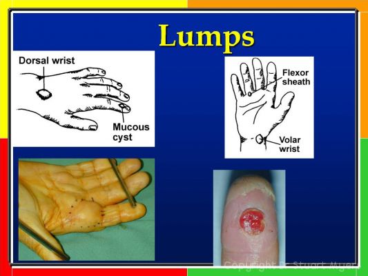 Hand And Wrist Examination