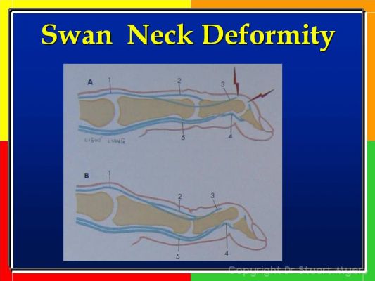 Hand and Wrist Examination