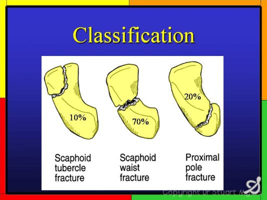 Assessment of Sporting Wrist Injuries for Physiotherapists