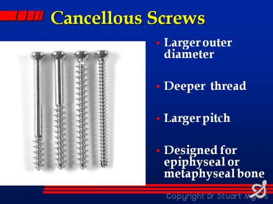 Principles of Plate Fixation