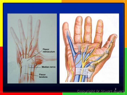 Carpal Tunnel Syndrome for Nurses