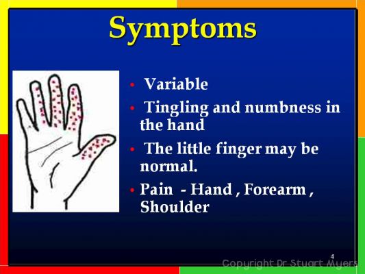 Carpal Tunnel Syndrome for Nurses